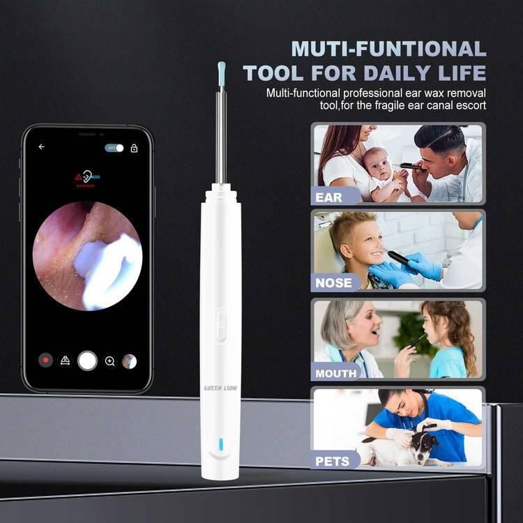 Earwax Removal Using a Digital Otoscope at Home 